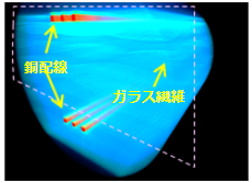 X線CT像 (3D像)