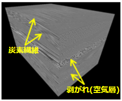 X線CT像 (3D像)