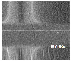 異常箇所のX線CT像 (基材平面像)