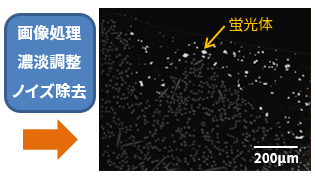 画像処理後 X線CT 断面像